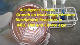 Alkaligenes faecalis Colony Morphology on Macconkey agar and Biochemical Reactions Demonstration [upl. by Yromas]